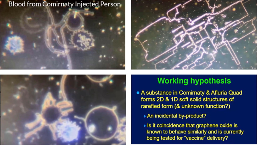  Dr. Robin Wakeling With Drs. Mark & Sam Bailey: Pfizer-Injected Blood Under the Microscope — Part 2 Shotsx